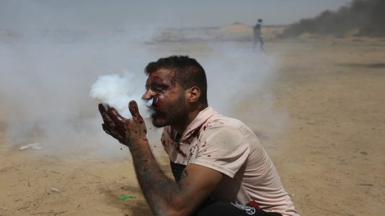 الاحتلال يصيب فلسطينيا من غزة بقنبلة غاز في فمه